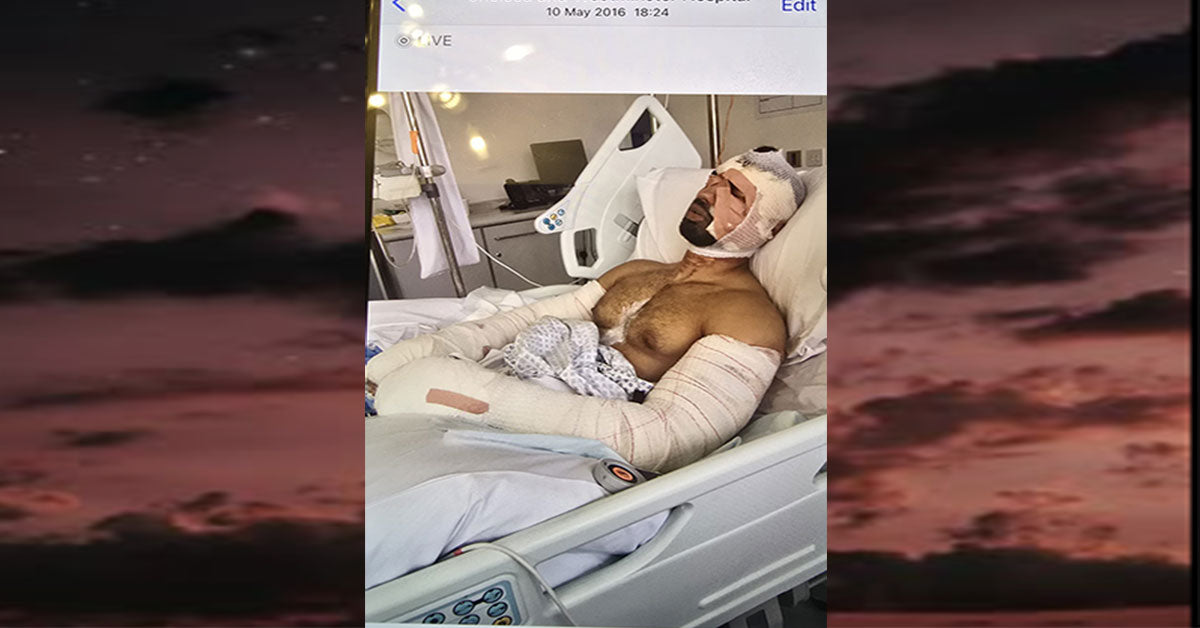 Khuram Rana in hospital bead with burns to face chest and both arms .Burns picture in Chelsea West Minister after trying to save mum in house fire. Skin Grafting and plastic surgery .Fit Life London Personal Trainer and Survivor Mental Health awareness.  Personal Training in West London Southall UB1 at VIP studio 4 mins away from Southall Station with Free Parking
