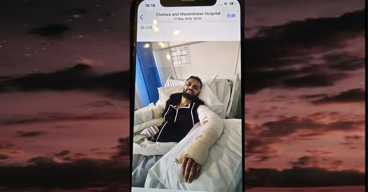 Khuram Rana Burns picture in Chelsea West Minister after trying to save mum in house fire. Skin Grafting and plastic surgery .Fit Life London Personal Trainer and Survivor Mental Health awareness.  Personal Training in West London Southall UB1 at VIP studio 4 mins away from Southall Station with Free Parking